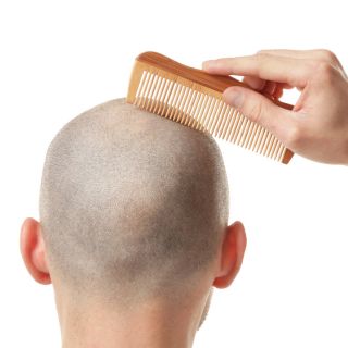 Previene la caduta dei capelli